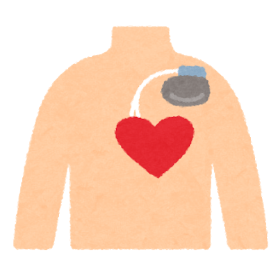 medical_pacemaker_body